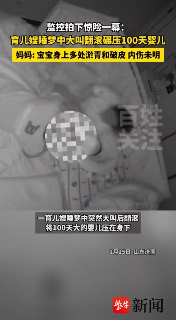现金九游体育app平台被压后肉体多处淤青破皮-九游(中国体育)娱乐 官方网站 登录入口
